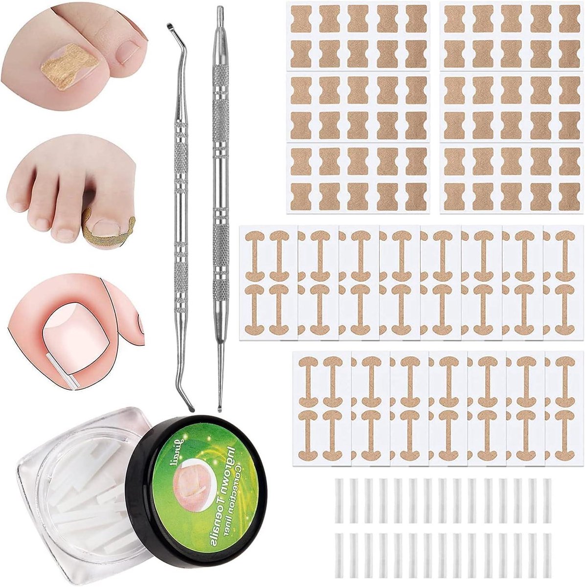 Ingelroeide teennagelset - 152 stuks met diverse instrumenten